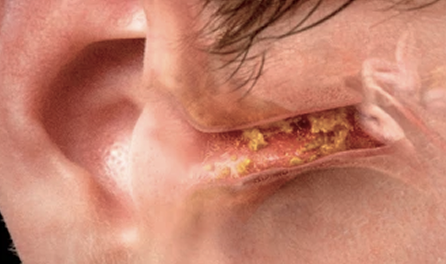 Ear canal reference